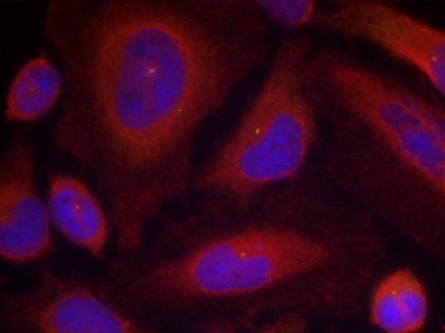 Phospho-Synaptotagmin 1 (Ser309) Antibody in Immunocytochemistry (ICC/IF)