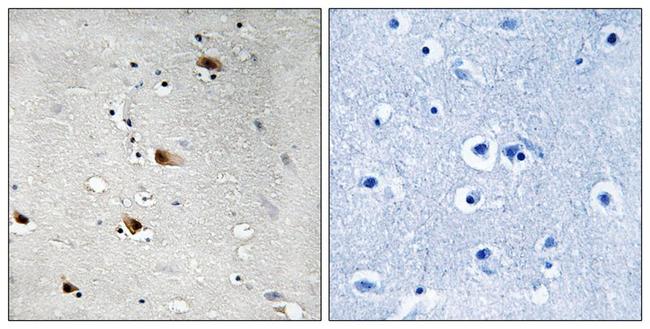 Phospho-TCF3 (Thr355) Antibody in Immunohistochemistry (Paraffin) (IHC (P))