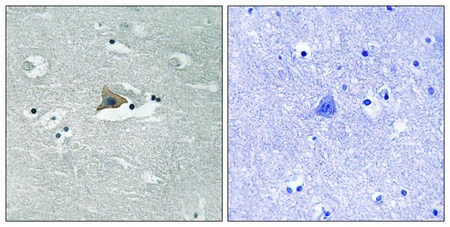 Phospho-Claudin 5 (Tyr217) Antibody in Immunohistochemistry (Paraffin) (IHC (P))