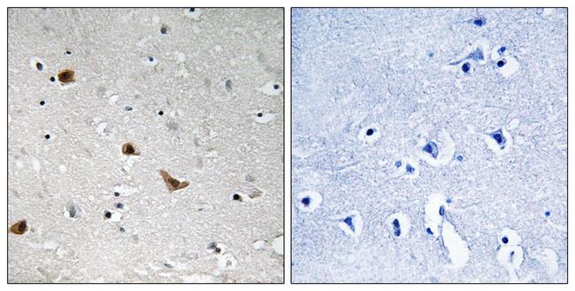 Phospho-IKK gamma (Ser376) Antibody in Immunohistochemistry (Paraffin) (IHC (P))