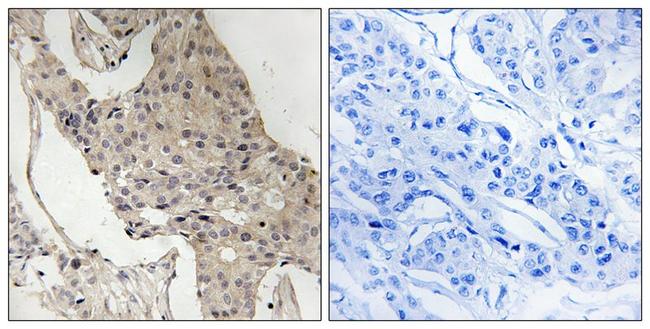 Phospho-GAB2 (Ser623) Antibody in Immunohistochemistry (Paraffin) (IHC (P))