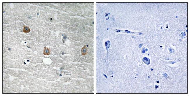 Phospho-TOB1 (Ser164) Antibody in Immunohistochemistry (Paraffin) (IHC (P))