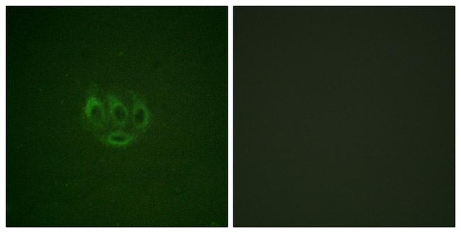 Phospho-ACK1 (Tyr284) Antibody in Immunocytochemistry (ICC/IF)