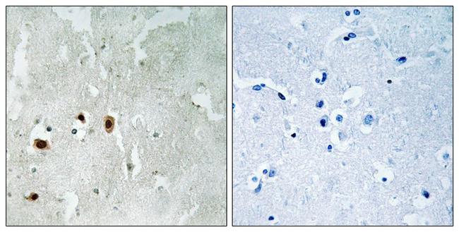 Phospho-TIP60 (Ser90) Antibody in Immunohistochemistry (Paraffin) (IHC (P))