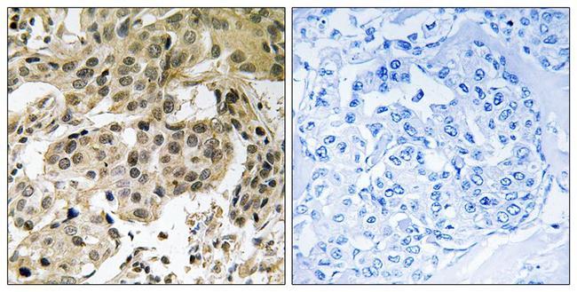 Phospho-HP1 alpha (Ser92) Antibody in Immunohistochemistry (Paraffin) (IHC (P))