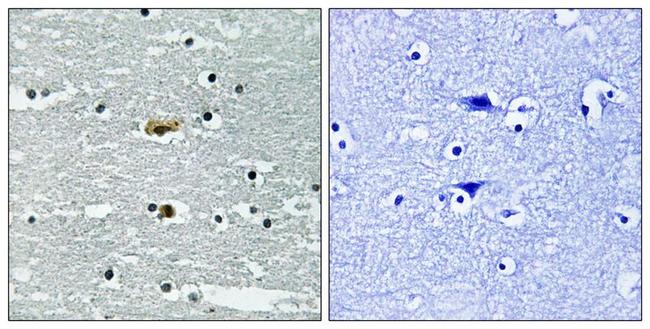 Phospho-STK39 (Ser309) Antibody in Immunohistochemistry (Paraffin) (IHC (P))