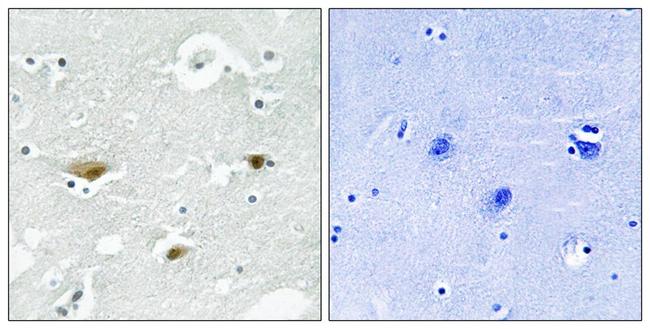 Phospho-STK39 (Ser323) Antibody in Immunohistochemistry (Paraffin) (IHC (P))