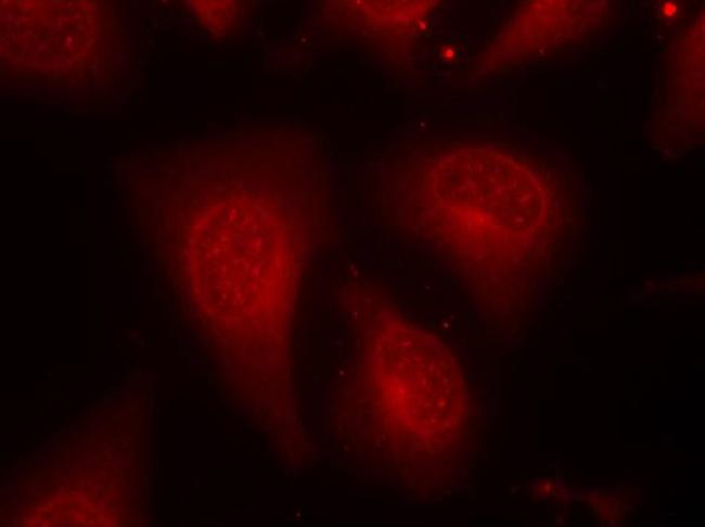 Phospho-HDAC8 (Ser39) Antibody in Immunocytochemistry (ICC/IF)