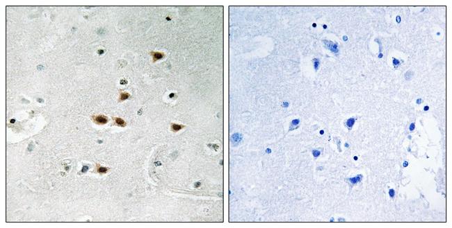 Phospho-ITCH (Tyr420) Antibody in Immunohistochemistry (Paraffin) (IHC (P))