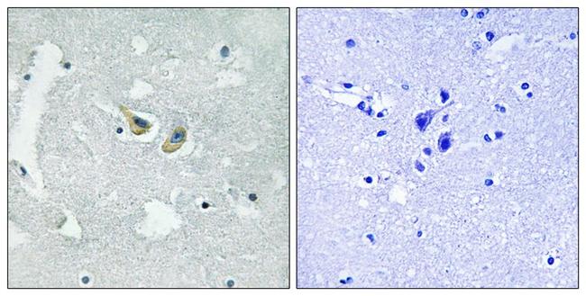 Phospho-p47phox (Ser345) Antibody in Immunohistochemistry (Paraffin) (IHC (P))