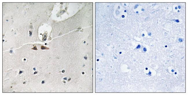 Phospho-Ephrin B1/B2/B3 (Tyr324/311/318) Antibody in Immunohistochemistry (Paraffin) (IHC (P))