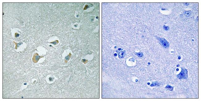 Phospho-MLK1/MLK2 (Thr312, Thr266) Antibody in Immunohistochemistry (Paraffin) (IHC (P))