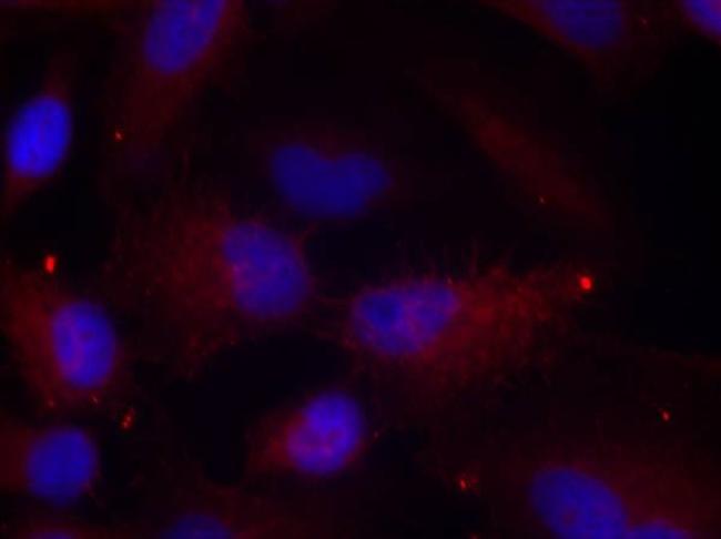 Phospho-PAK1/2/3 (Thr423, Thr402, Thr421) Antibody in Immunocytochemistry (ICC/IF)