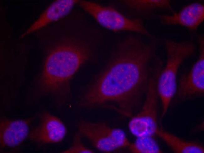 Phospho-JNK1/JNK2/JNK3 (Thr183, Tyr185) Antibody in Immunocytochemistry (ICC/IF)