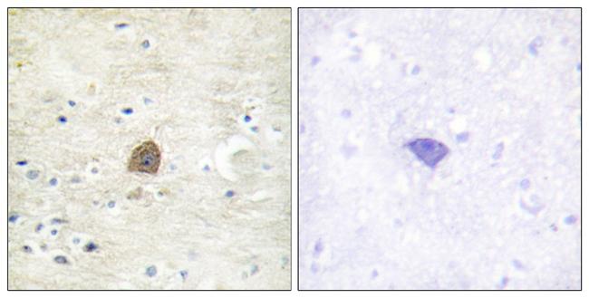 Phospho-CaMKII alpha/beta/delta (Thr305) Antibody in Immunohistochemistry (Paraffin) (IHC (P))