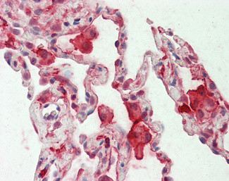 CAPG Antibody in Immunohistochemistry (Paraffin) (IHC (P))