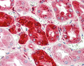 Cathepsin C Antibody in Immunohistochemistry (Paraffin) (IHC (P))