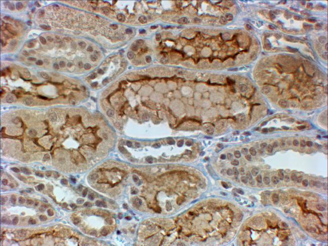 COL4A3 Antibody in Immunohistochemistry (Paraffin) (IHC (P))