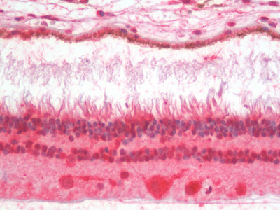 CRX Antibody in Immunohistochemistry (Paraffin) (IHC (P))