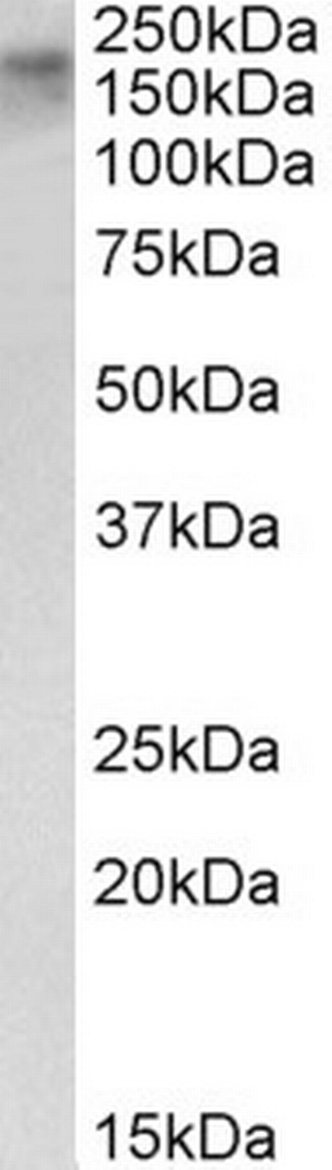 CSB Antibody in Western Blot (WB)