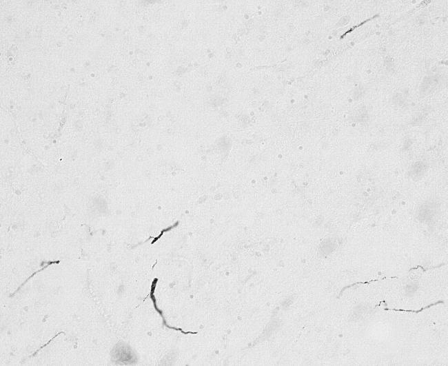 FGF14 Antibody in Immunohistochemistry (PFA fixed) (IHC (PFA))