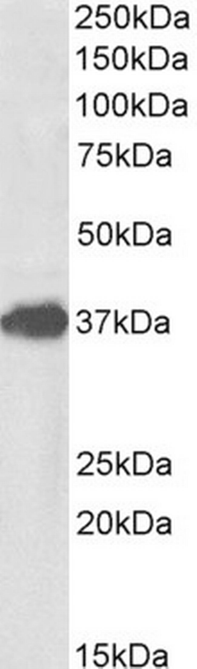 FOXF1 Antibody in Western Blot (WB)