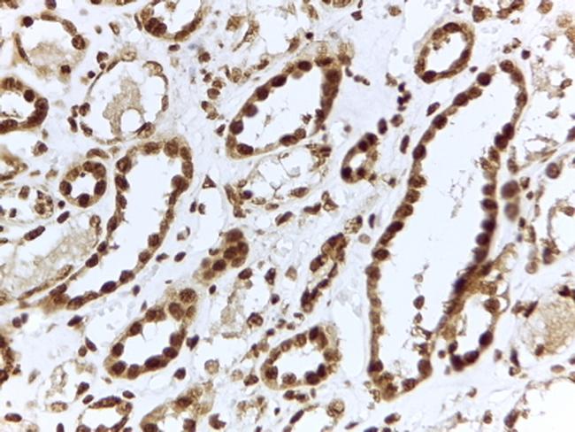 ILF3 Antibody in Immunohistochemistry (Paraffin) (IHC (P))