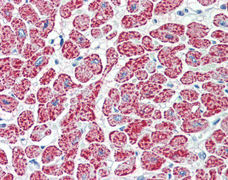 NDUFA7 Antibody in Immunohistochemistry (Paraffin) (IHC (P))