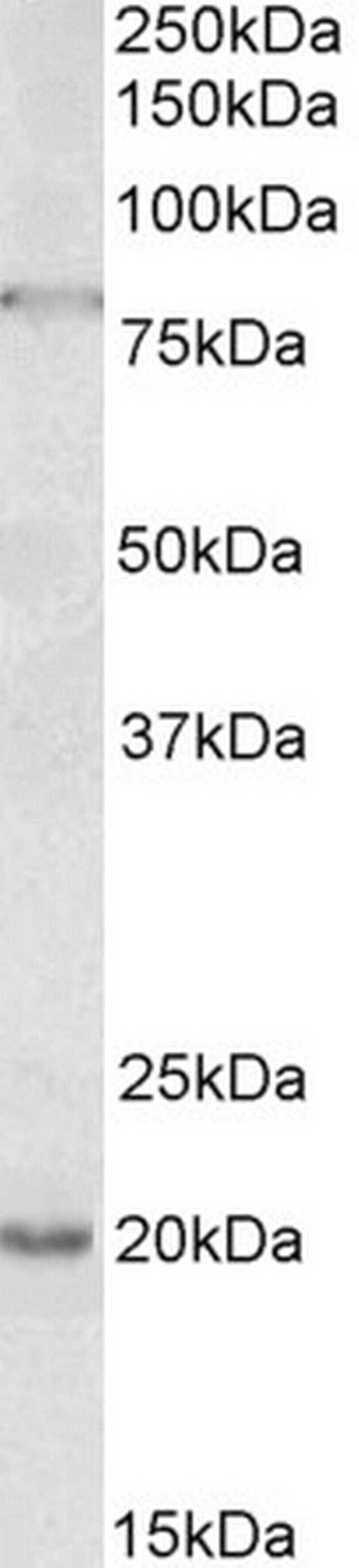 OAS2 Antibody in Western Blot (WB)