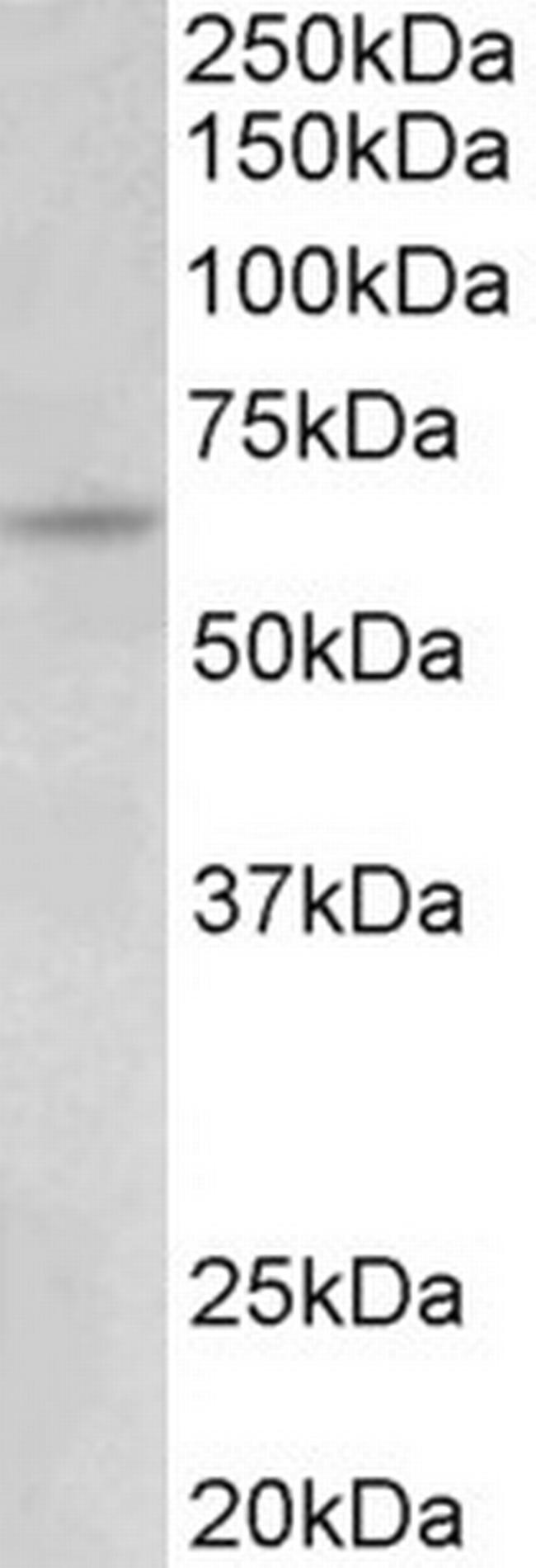 Uromodulin Antibody in Western Blot (WB)