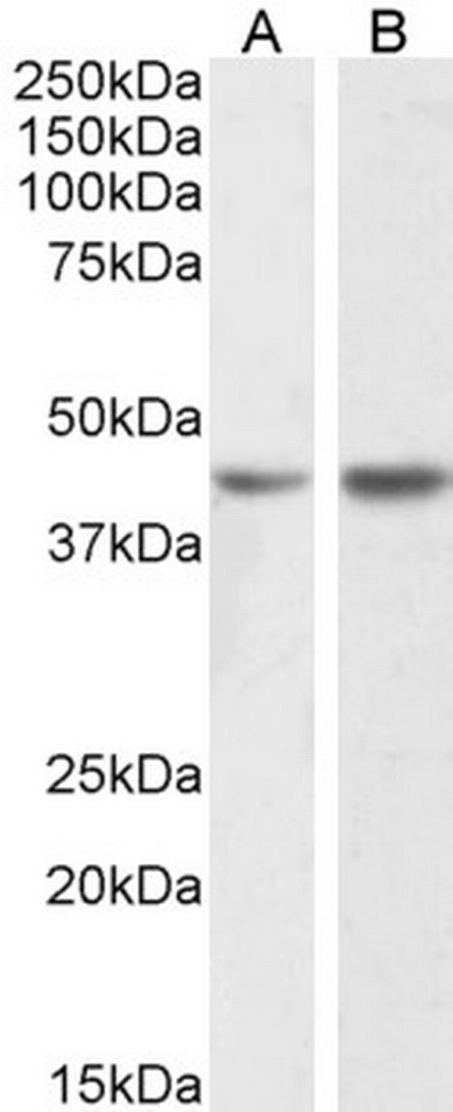 Podocin Antibody in Western Blot (WB)