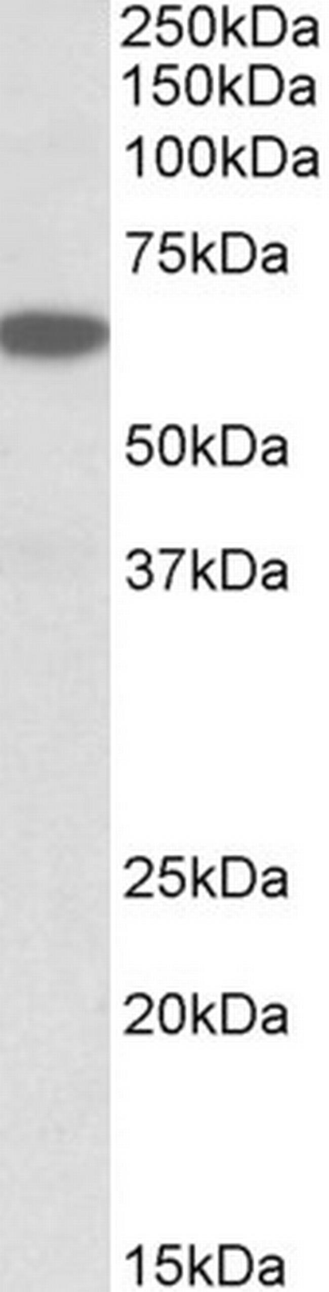 PLA2G4C Antibody in Western Blot (WB)