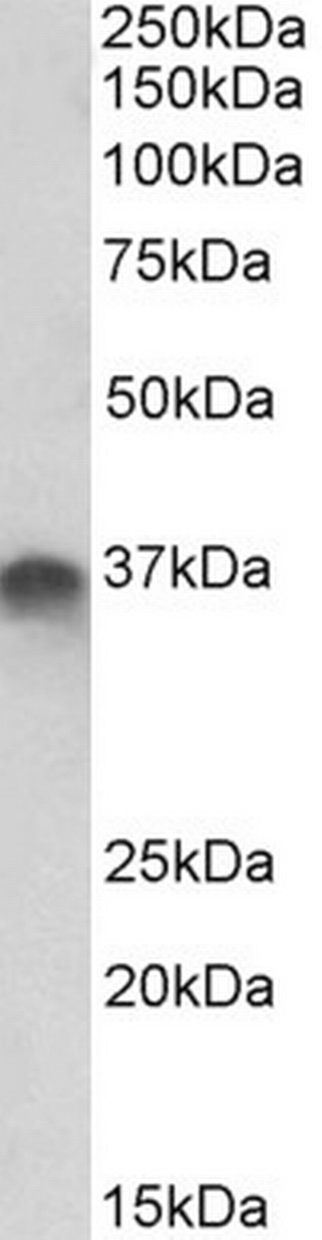 STX11 Antibody in Western Blot (WB)