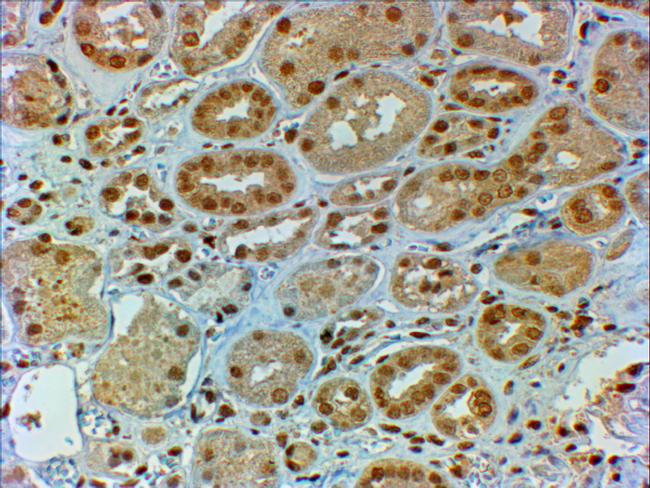 DMRT2 Antibody in Immunohistochemistry (Paraffin) (IHC (P))