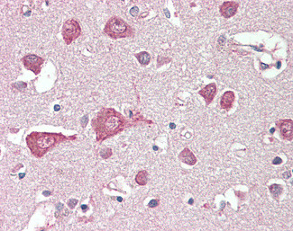 MLC1 Antibody in Immunohistochemistry (Paraffin) (IHC (P))