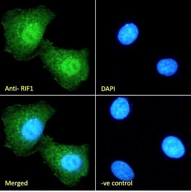 RIF1 Antibody in Immunocytochemistry (ICC/IF)