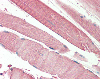 THNSL2 Antibody in Immunohistochemistry (Paraffin) (IHC (P))