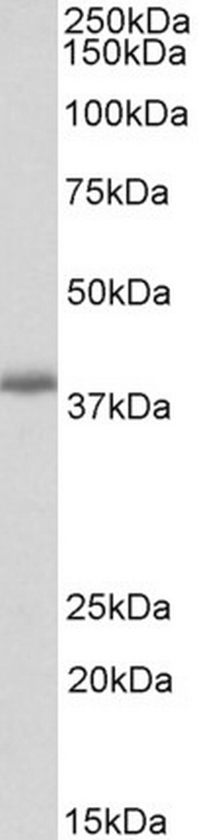 PDLIM2 Antibody in Western Blot (WB)