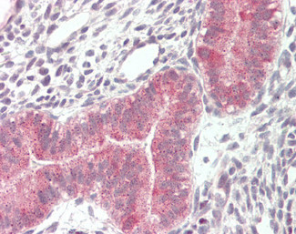 VPS16 Isoform 1 Antibody in Immunohistochemistry (Paraffin) (IHC (P))