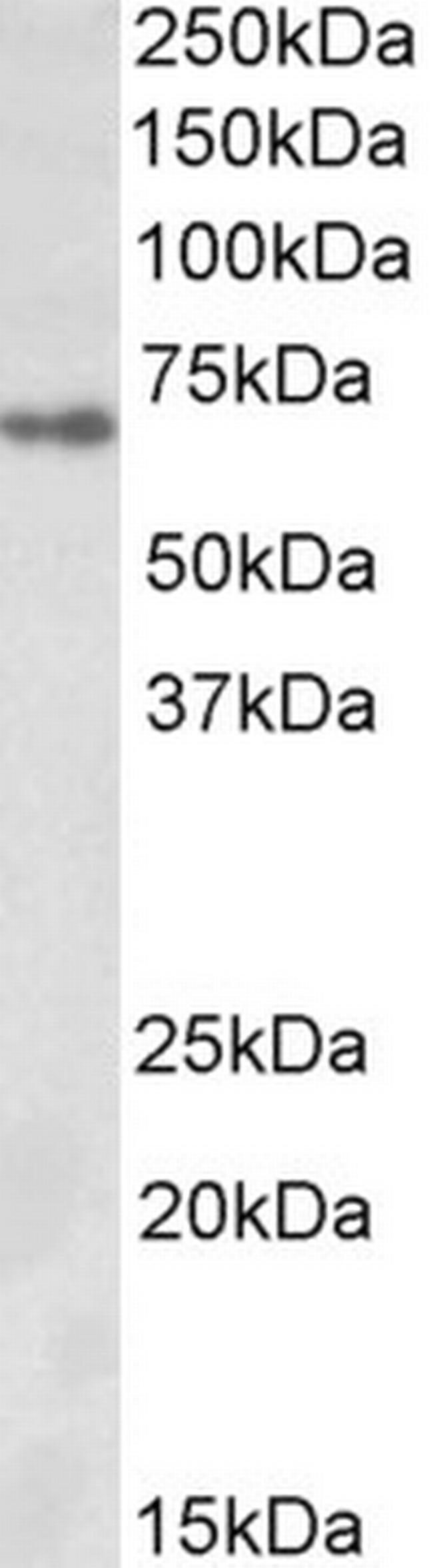 Zfp157 Antibody in Western Blot (WB)