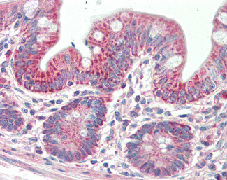 PTCD2 Antibody in Immunohistochemistry (Paraffin) (IHC (P))