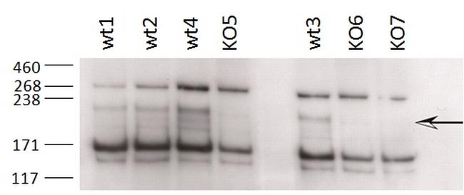 ZCCHC11 Antibody in Western Blot (WB)