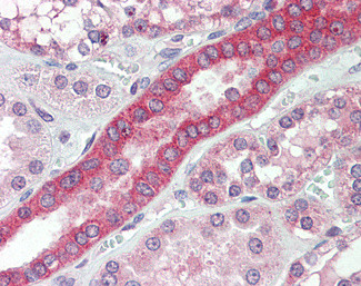 MYO1H Antibody in Immunohistochemistry (Paraffin) (IHC (P))