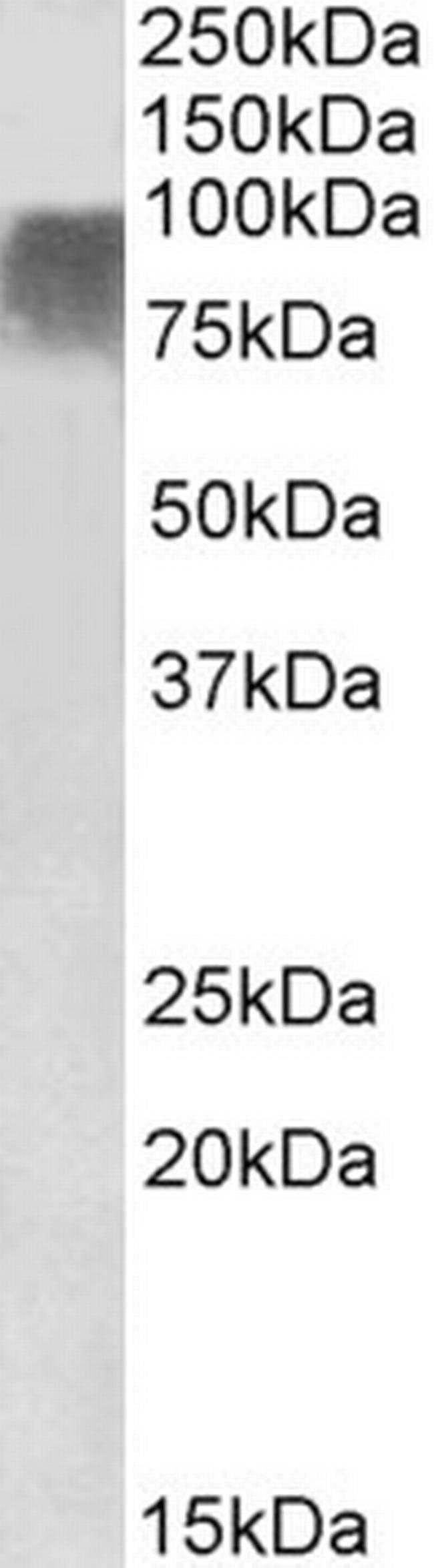 PRDM9 Antibody in Western Blot (WB)