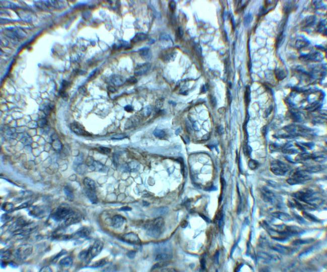 ENT2 Antibody in Immunohistochemistry (IHC)