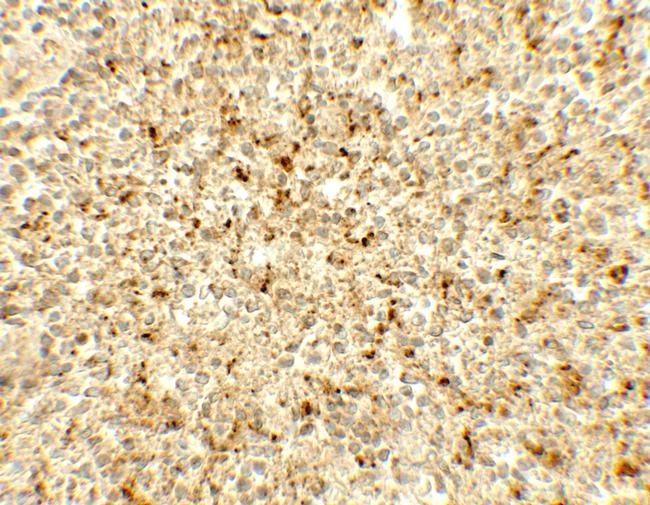 ME2 Antibody in Immunohistochemistry (Paraffin) (IHC (P))