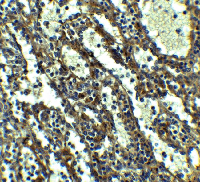 QSOX1 Antibody in Immunohistochemistry (IHC)