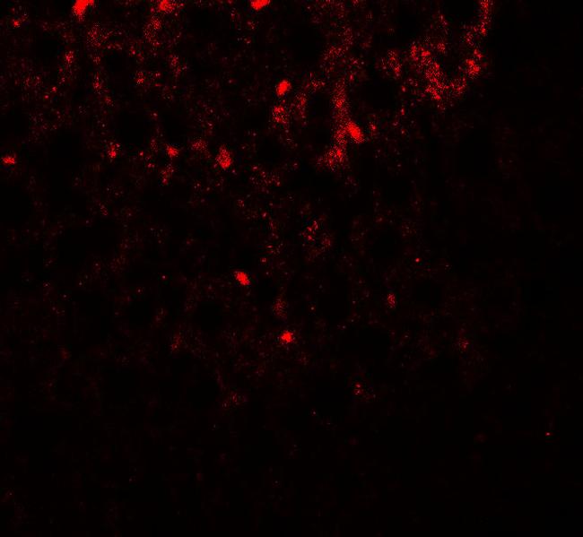 SHBG Antibody in Immunohistochemistry (IHC)