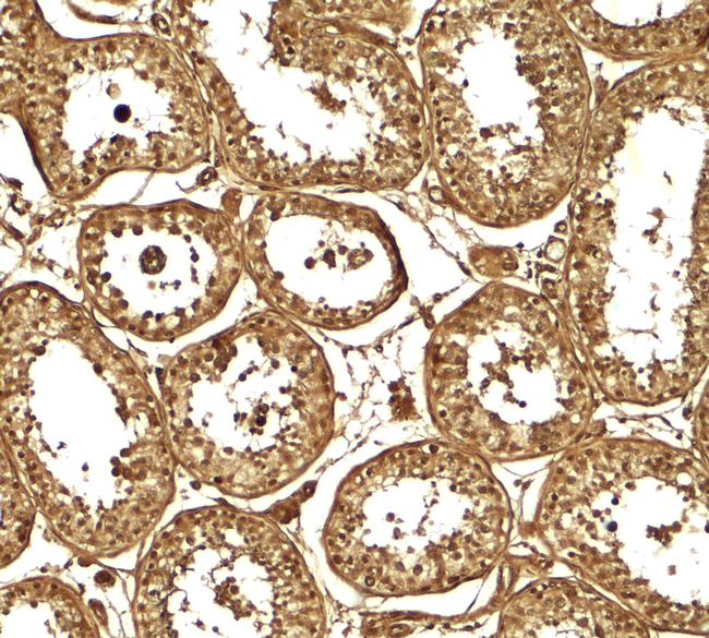 AKAP4 Antibody in Immunohistochemistry (Paraffin) (IHC (P))