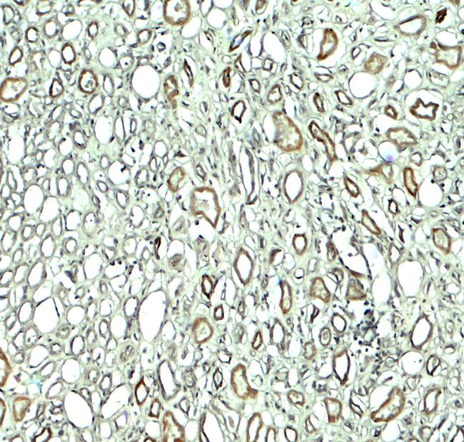 Rubicon Antibody in Immunohistochemistry (Paraffin) (IHC (P))